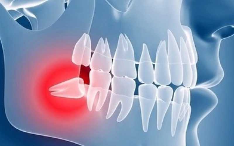 polski dentysta