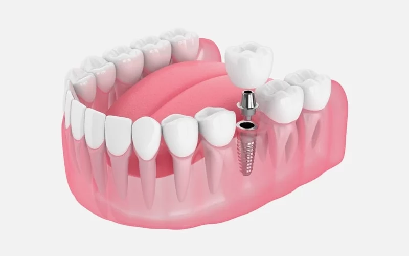 polski dentysta londyn near me