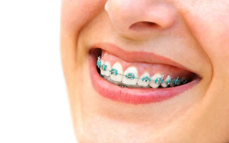 polski dentysta londyn ealing