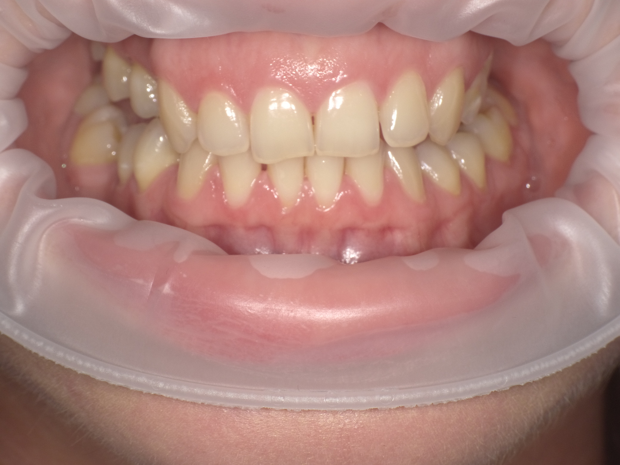 Shofu Dental Digital Camera - Perfect Smile Dental Centre