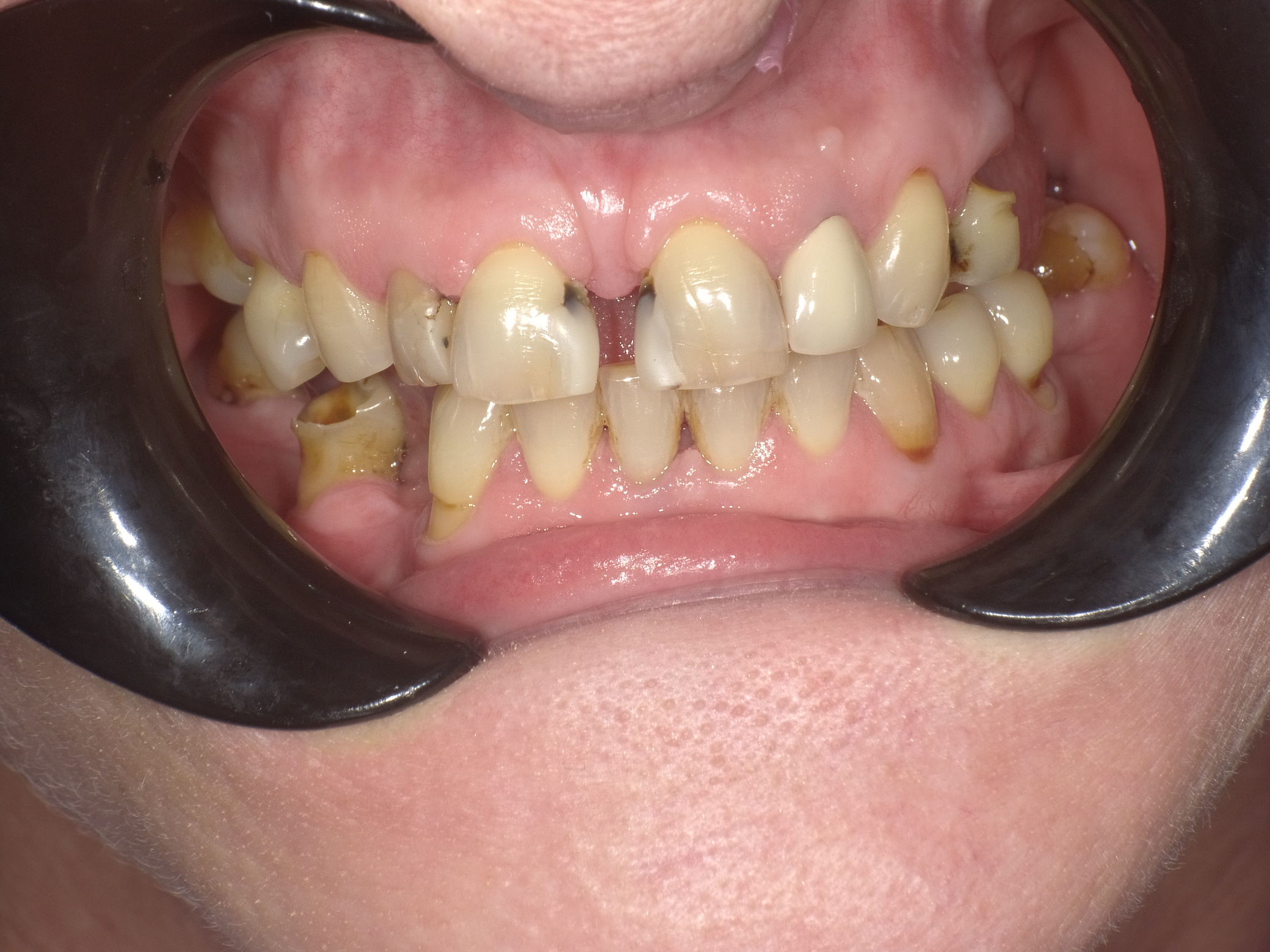 Shofu Dental Digital Camera - Perfect Smile Dental Centre