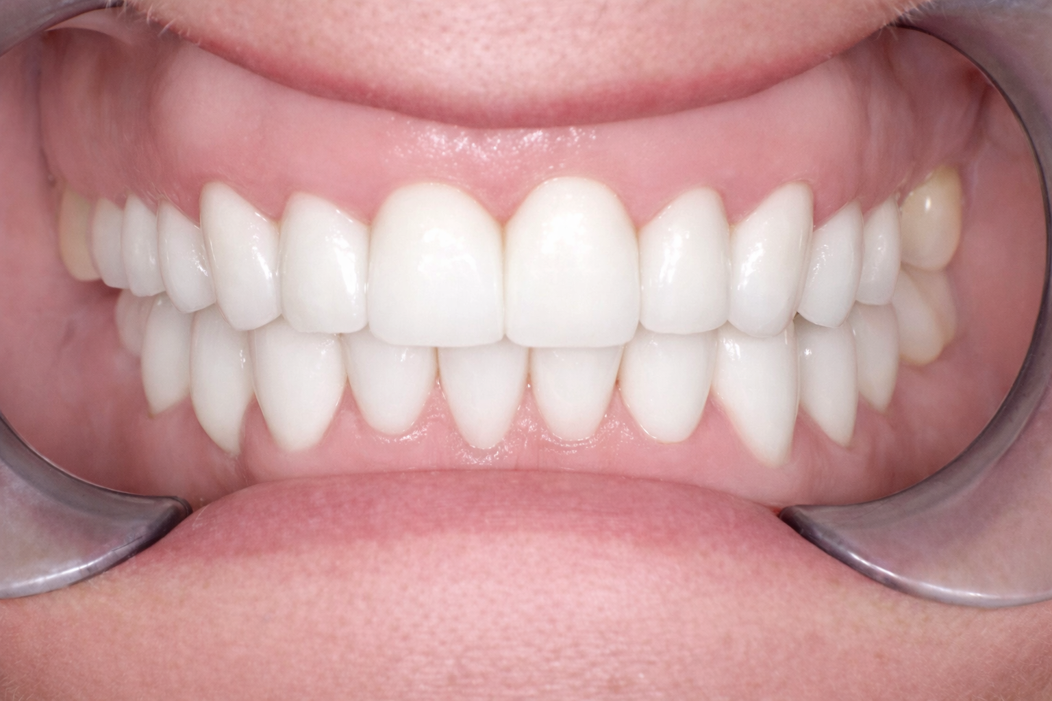 Pict0388 – Edit - Perfect Smile Dental Centre