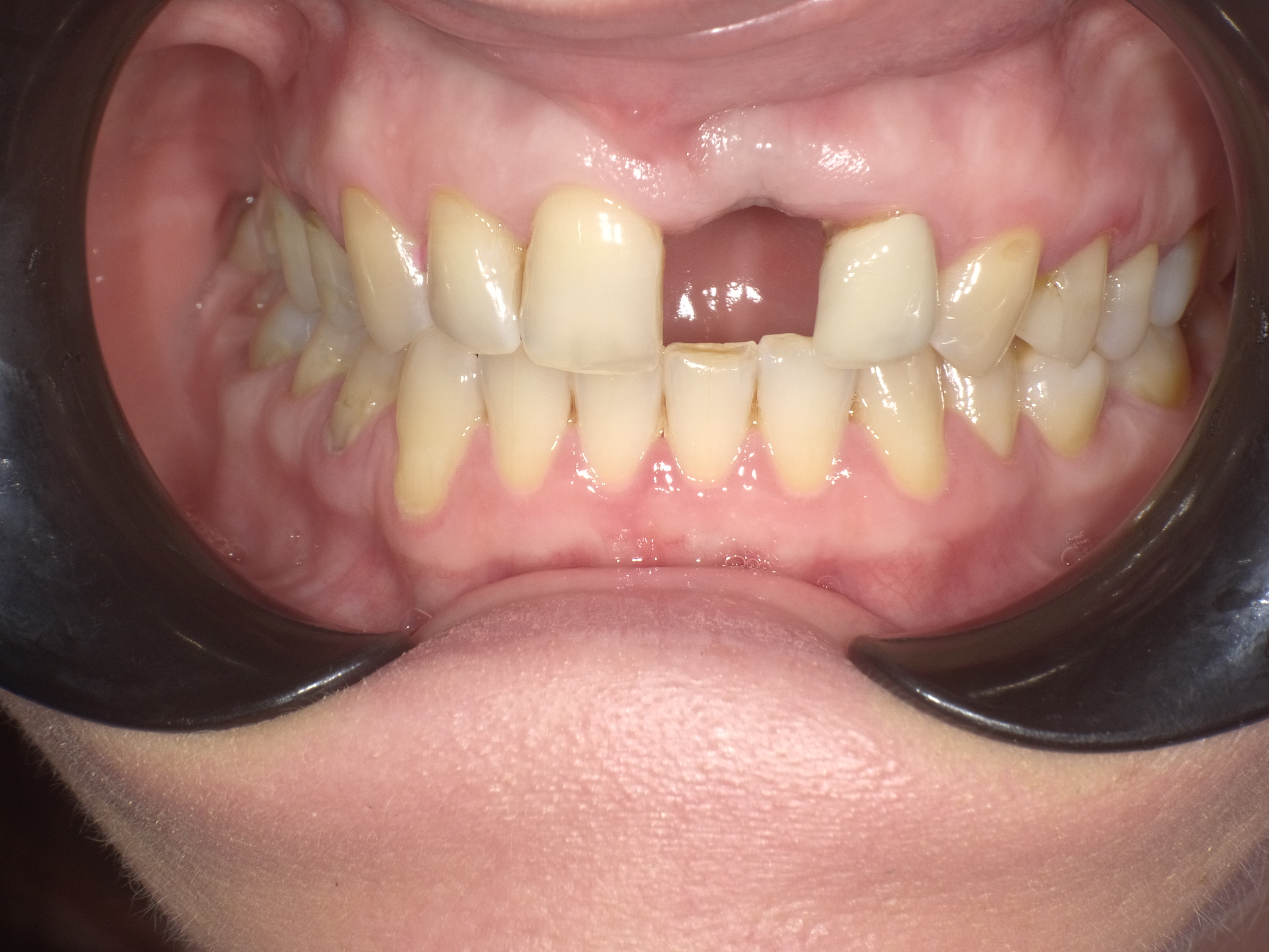 Shofu Dental Digital Camera - Perfect Smile Dental Centre