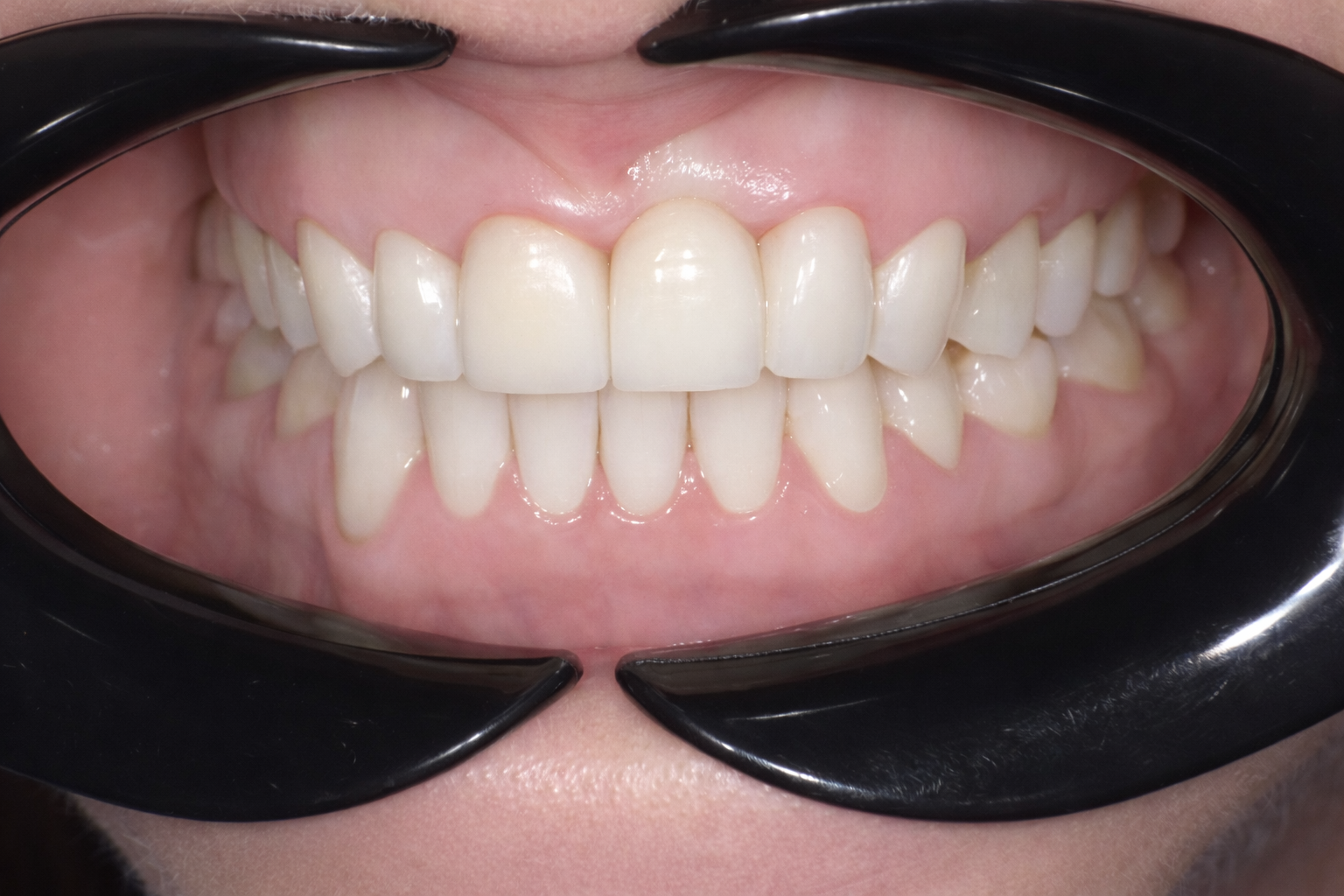 Pict0572 (1) – Edit - Perfect Smile Dental Centre