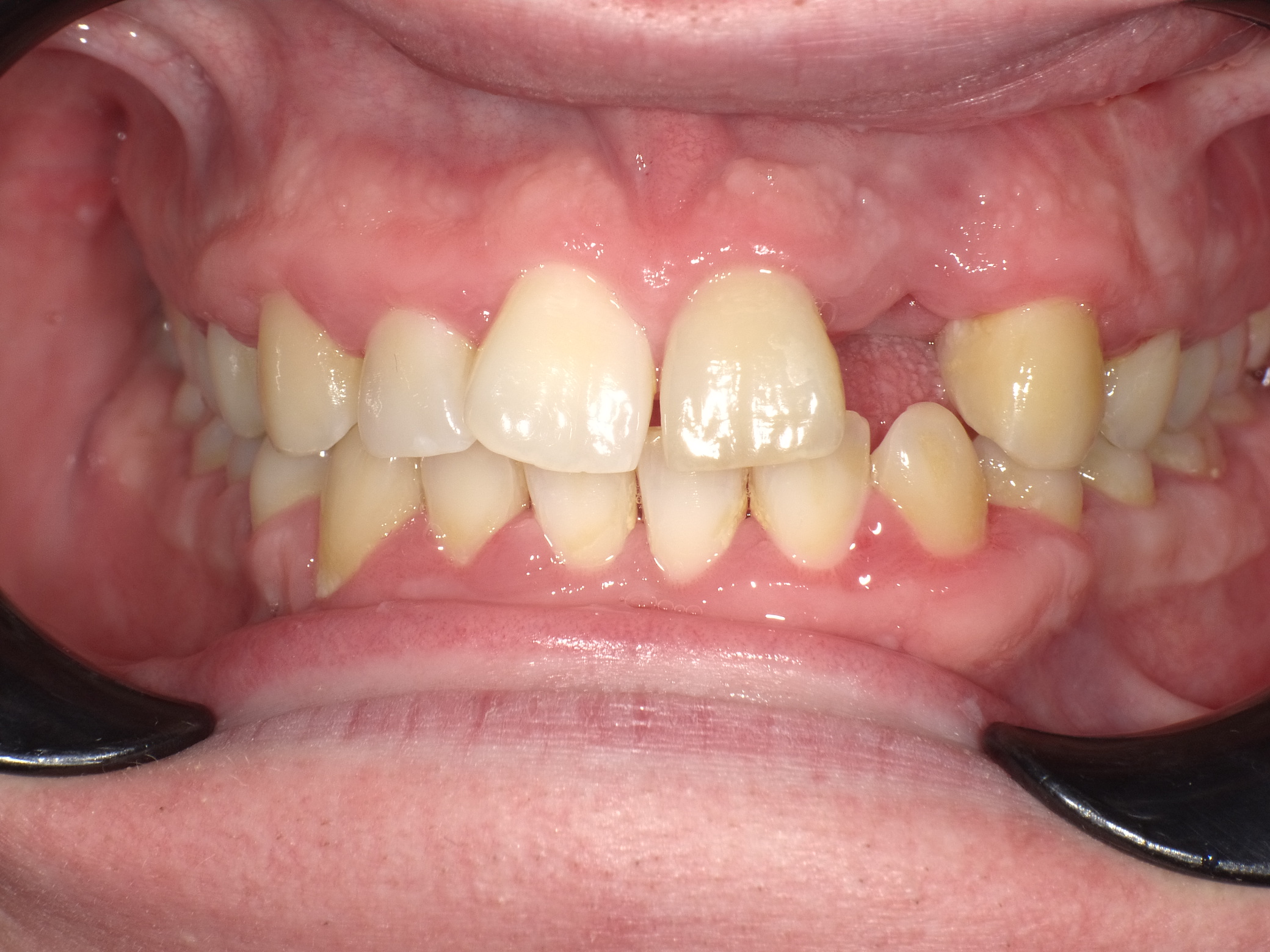Shofu Dental Digital Camera - Perfect Smile Dental Centre