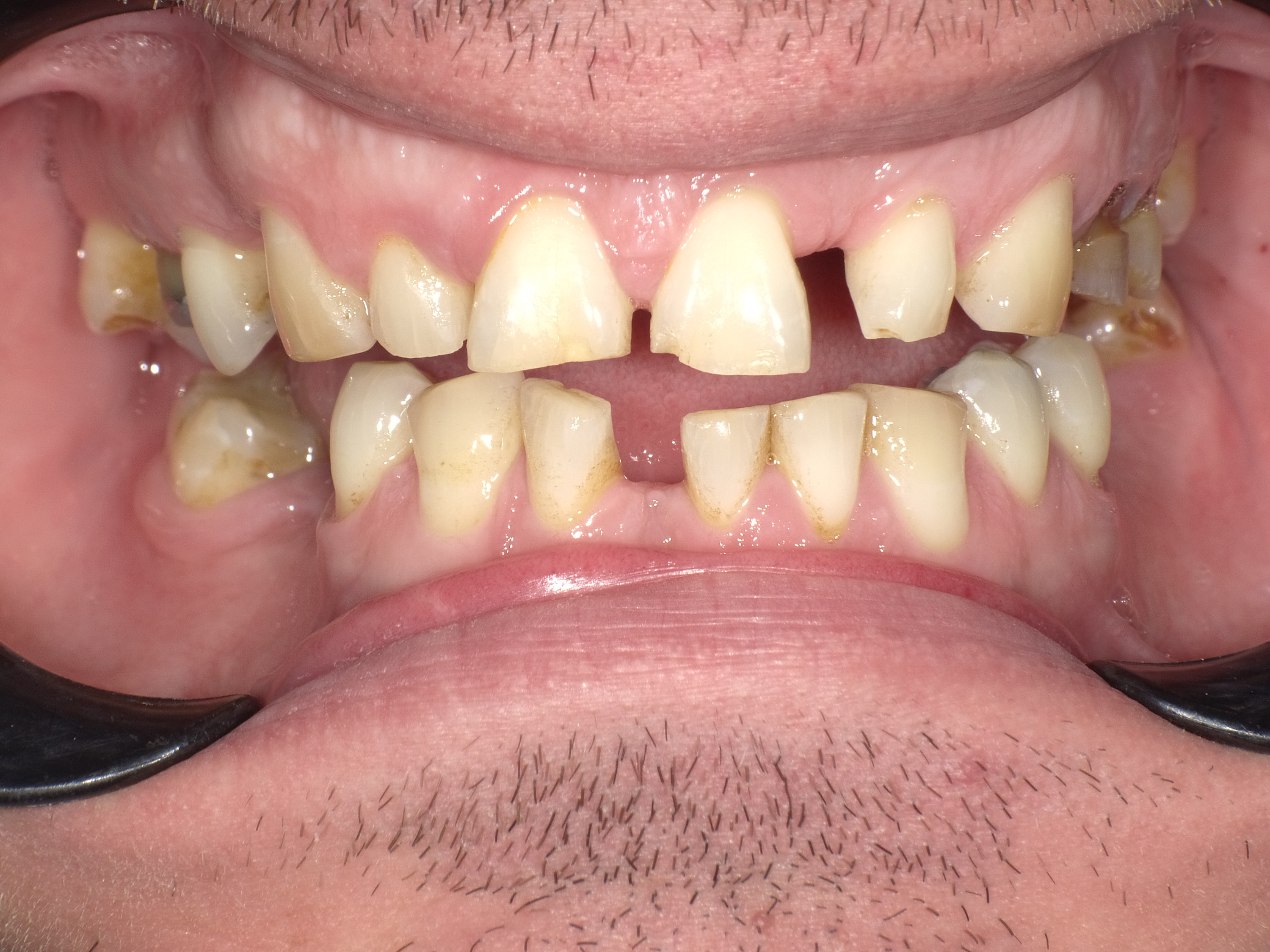 Shofu Dental Digital Camera - Perfect Smile Dental Centre