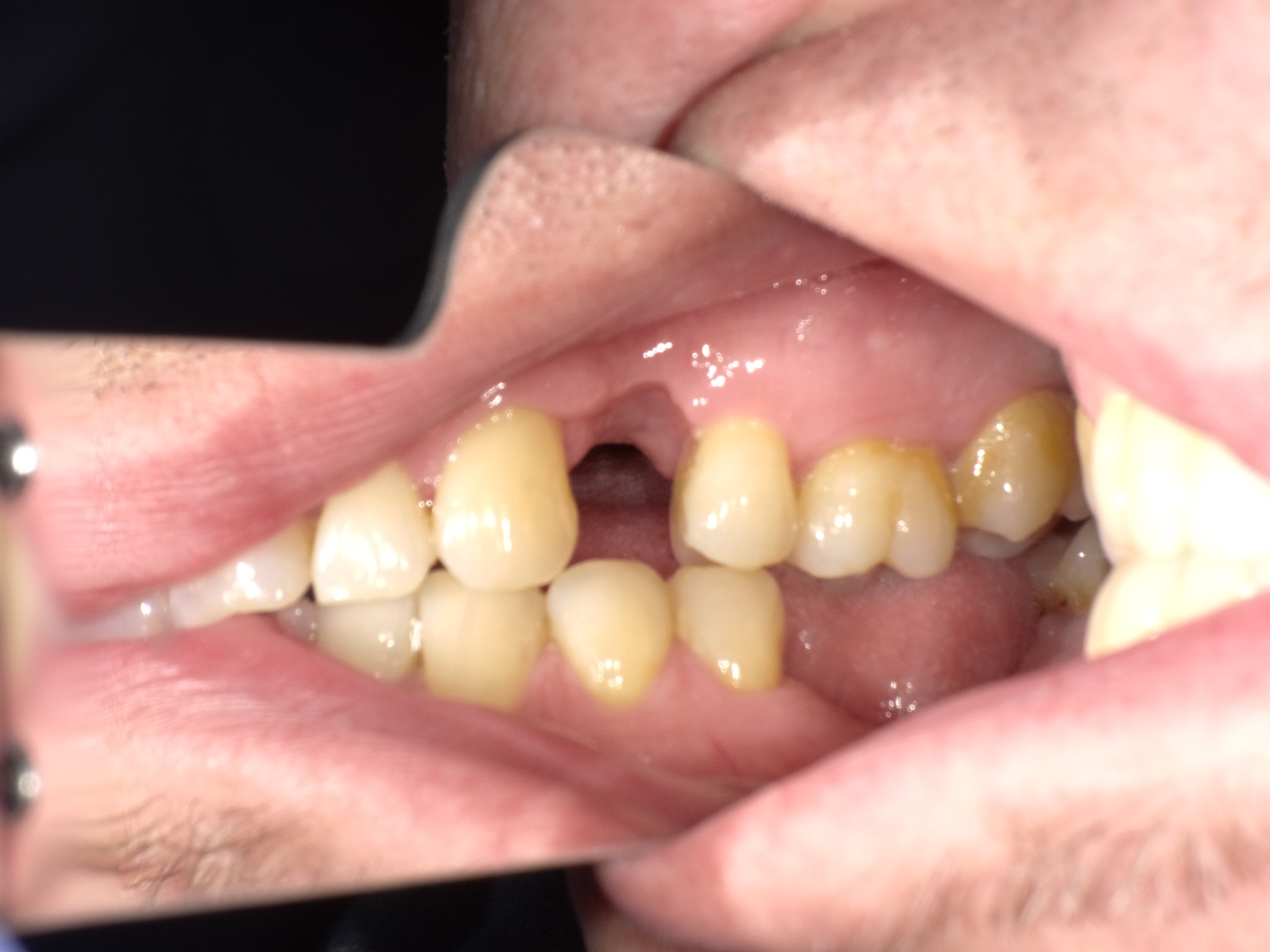 Shofu Dental Digital Camera - Perfect Smile Dental Centre