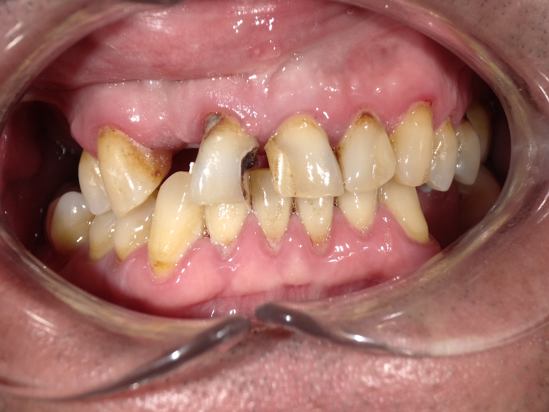 Shofu Dental Digital Camera - Perfect Smile Dental Centre