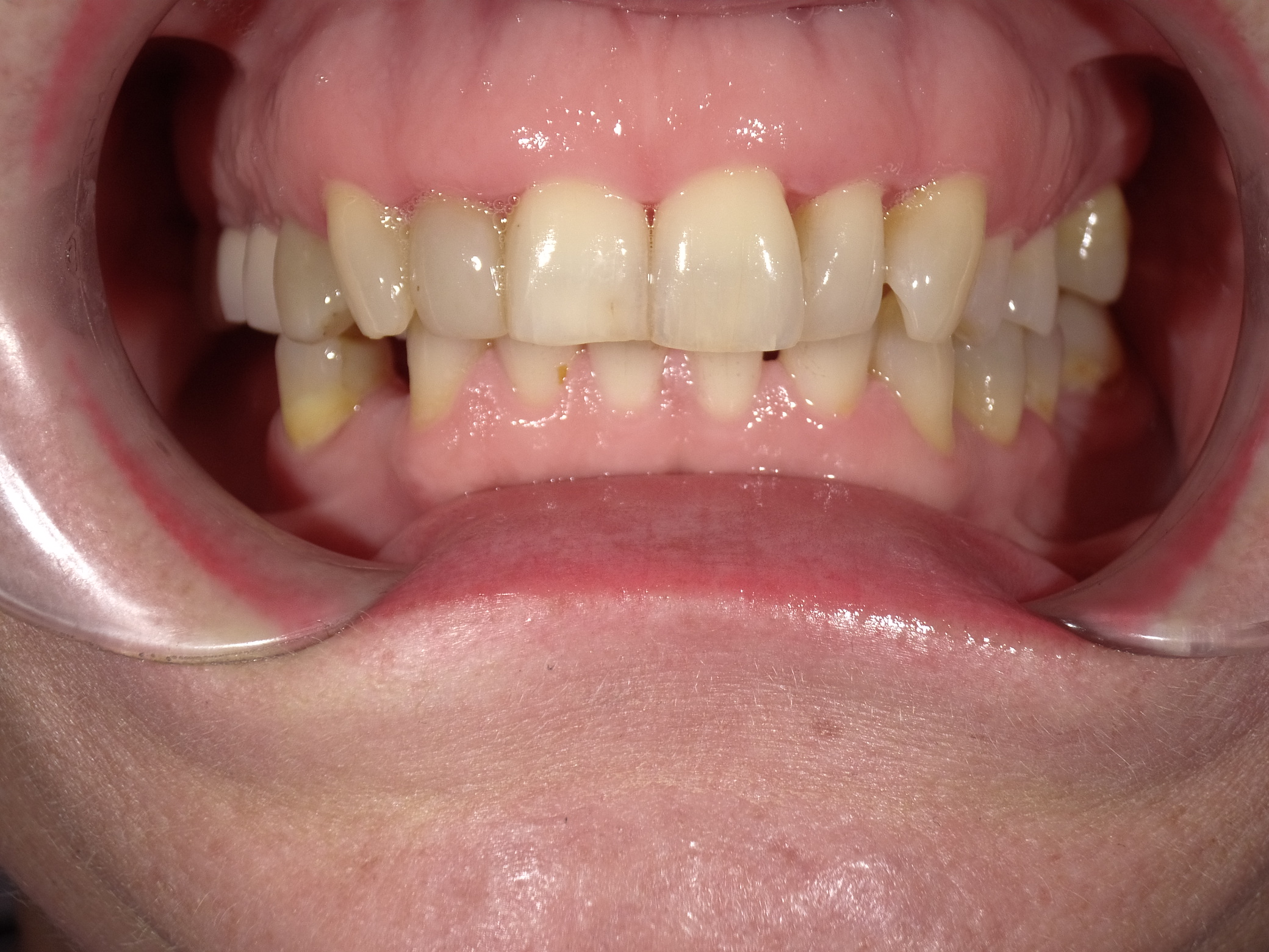 Shofu Dental Digital Camera - Perfect Smile Dental Centre