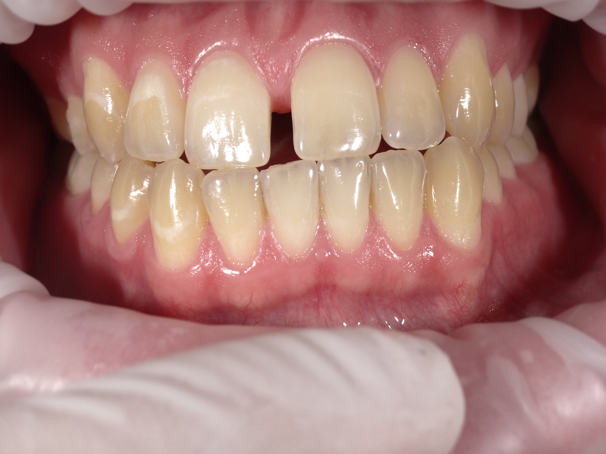 Shofu Dental Digital Camera - Perfect Smile Dental Centre