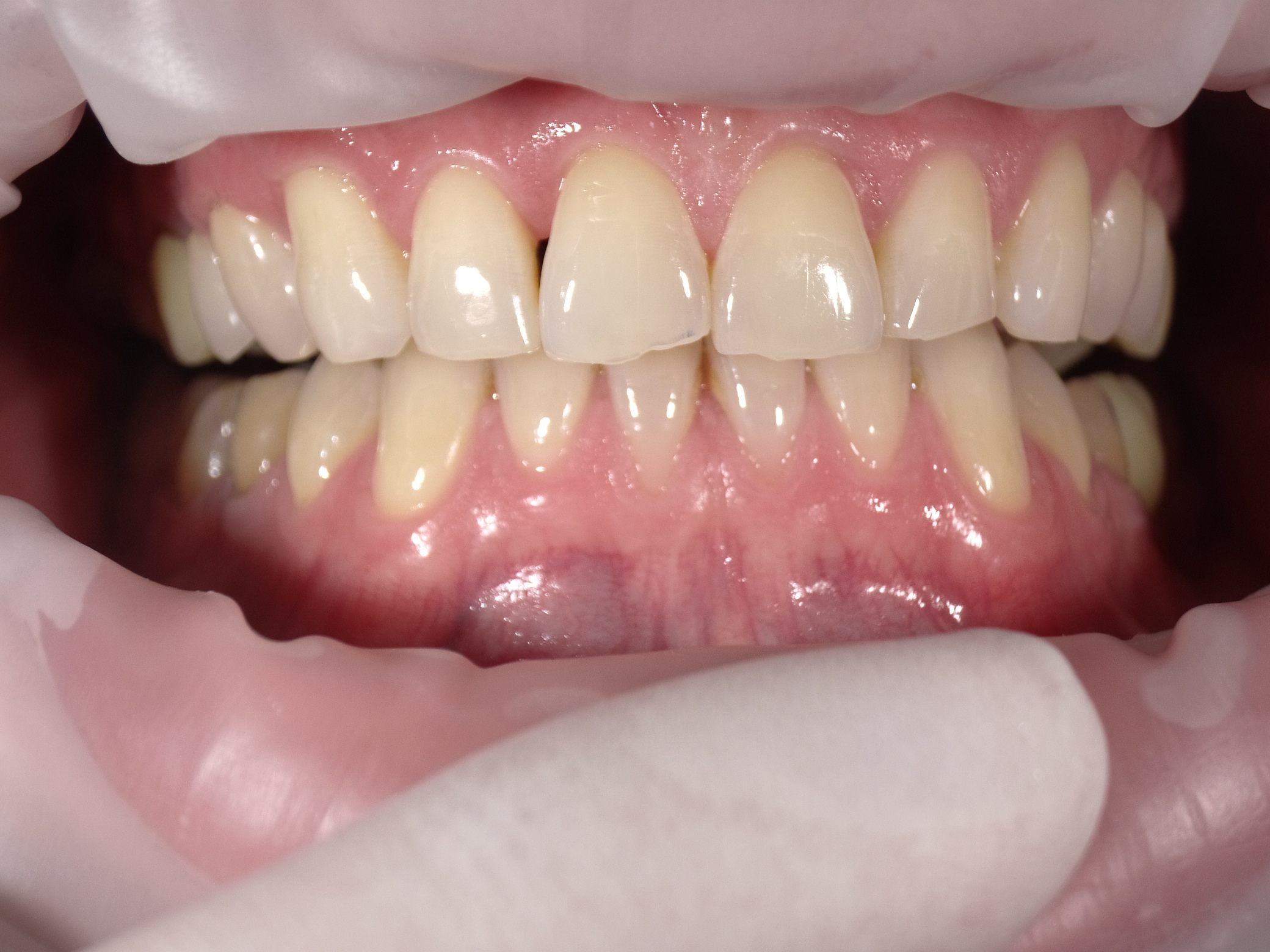 Shofu Dental Digital Camera - Perfect Smile Dental Centre