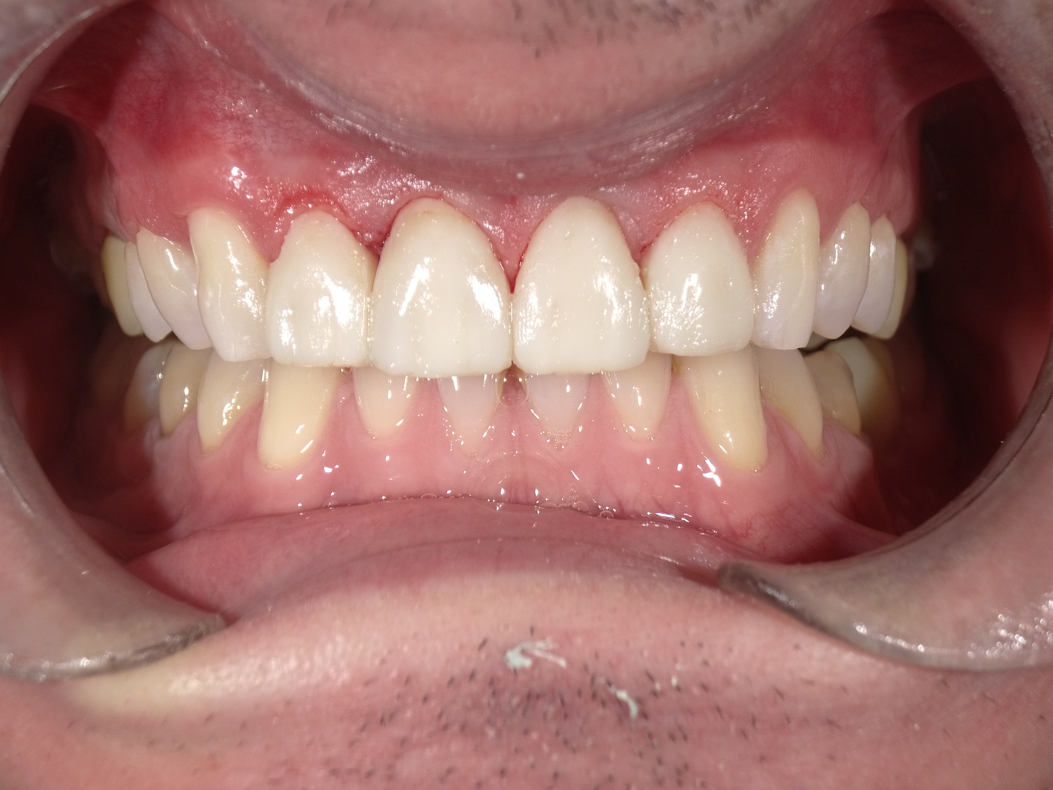 Shofu Dental Digital Camera - Perfect Smile Dental Centre