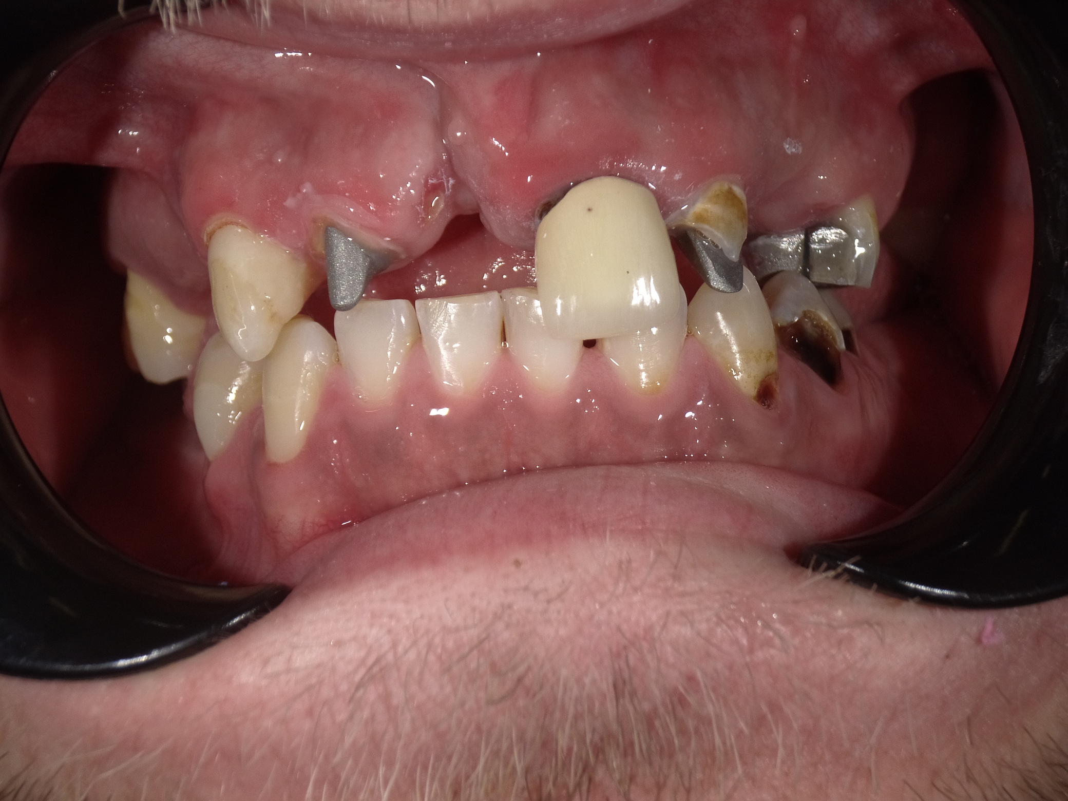 Shofu Dental Digital Camera - Perfect Smile Dental Centre