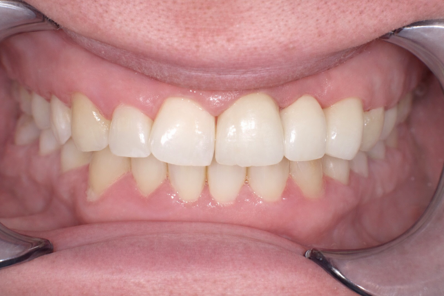 Pict8636 (2) – Edit - Perfect Smile Dental Centre