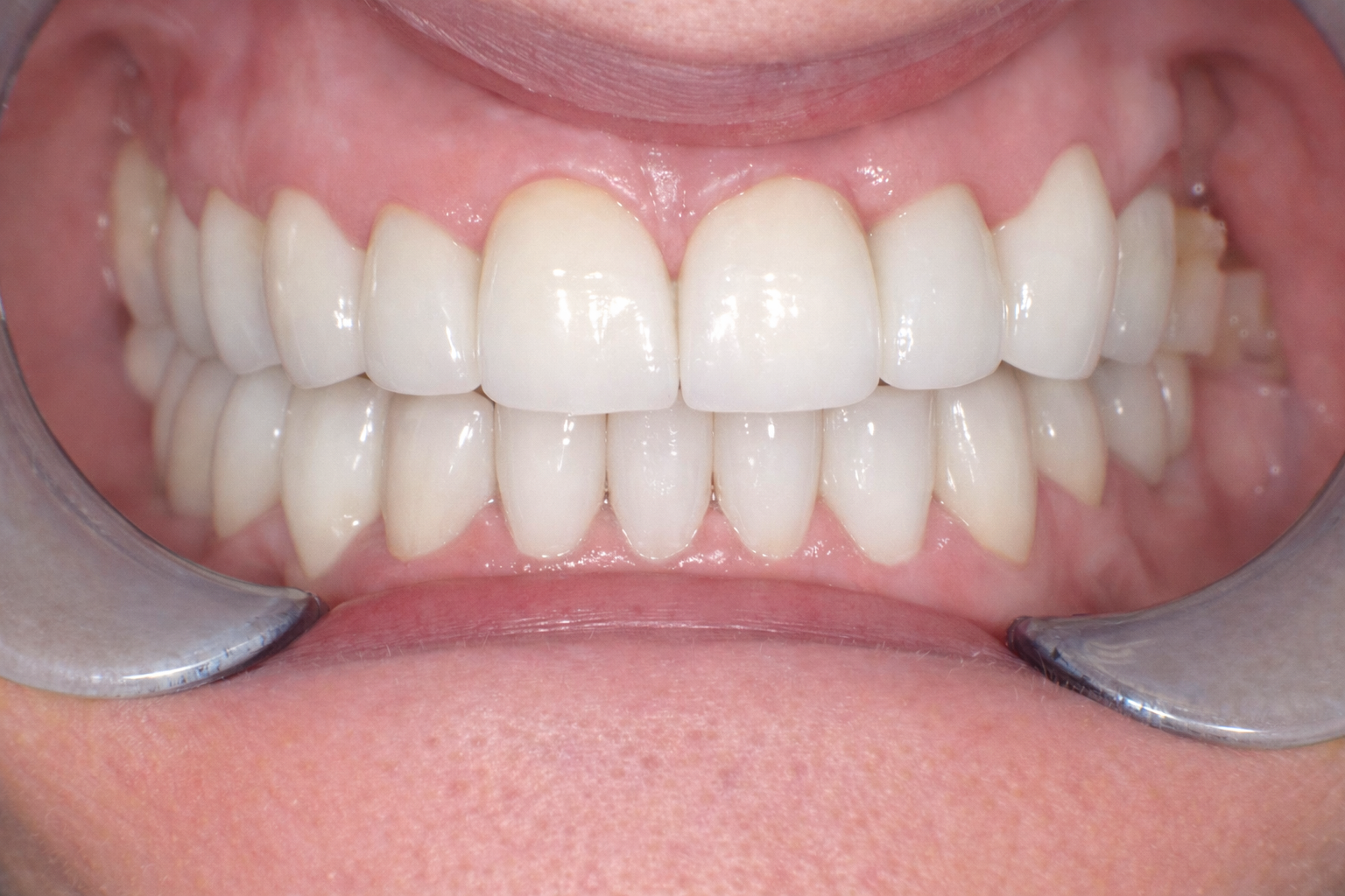Pict8645 – Edit - Perfect Smile Dental Centre